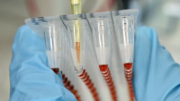 Erreur fatale dans les tests Ebola pourrait être risquer des vies