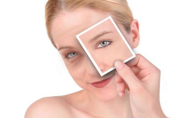 Débarrassez-vous des cernes sous les yeux Accueil spécial Remèdes
