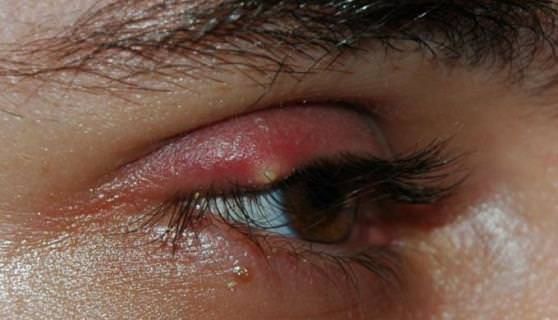 Accueil recours pour le traitement des yeux Orgelet