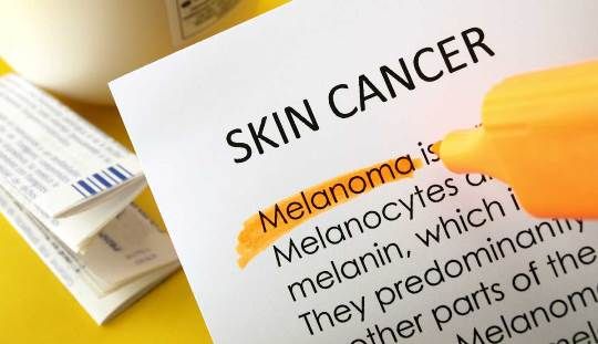 Accueil recours pour le traitement du cancer de la peau naturellement