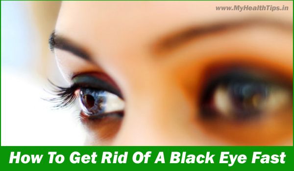 Comment se débarrasser d'un rapide Black Eye