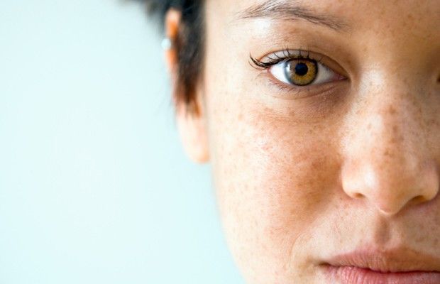 Comment se débarrasser des taches brunes sur la peau