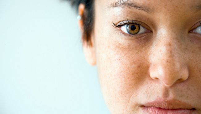 Comment se débarrasser des taches brunes sur la peau