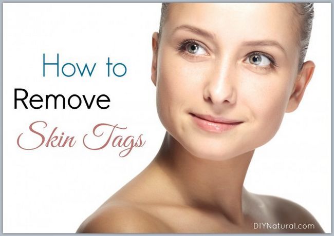 Comment faire pour supprimer la peau Tags