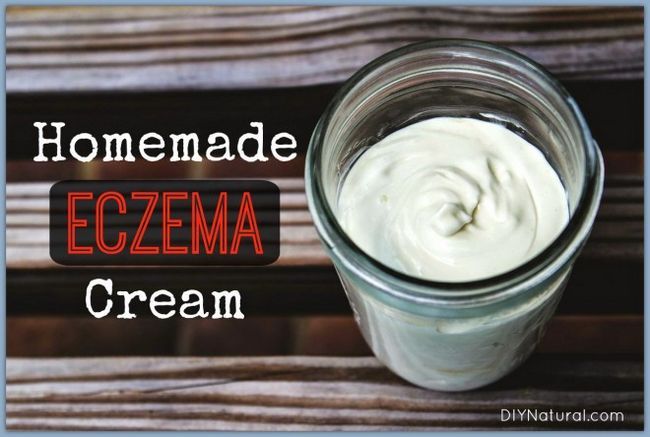 Homemade eczéma Crème