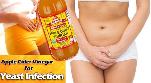Apple Cider Vinegar pour les infections à levures