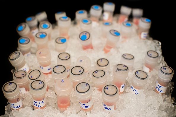 Liquide céphalo-rachidien de personnes atteintes du syndrome de fatigue chronique montre des différences de personnes en bonne santé. Liquide céphalo-rachidien de personnes atteintes du syndrome de fatigue chronique montre des différences de personnes en bonne santé.