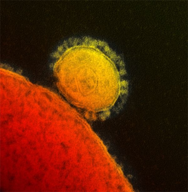 Une micrographie électronique de la MERS virus.