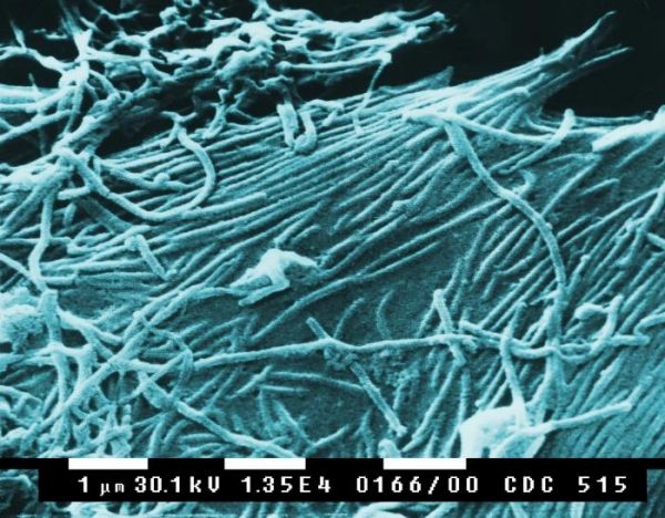 fibres ebola fibres ebola