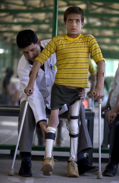 Un garçon afghan qui avait la polio est équipé de nouvelles accolades pour ses jambes. Les faibles taux de vaccination contre la polio aux États-Unis pourraient apporter la maladie dos.