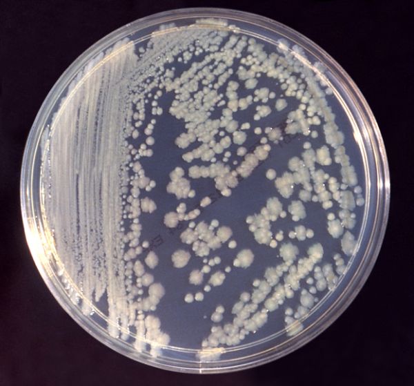 Une boîte de Pétri de bactéries Enterobacter, le genre qui semble prendre le dessus dans un petit échantillon de patients brûlés.