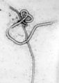 Une micrographie électronique d'une particule virale Ebola montrant la structure filamenteuse caractéristique d'un Filoviridae. Une micrographie électronique d'une particule virale Ebola montrant la structure filamenteuse caractéristique d'un Filoviridae.