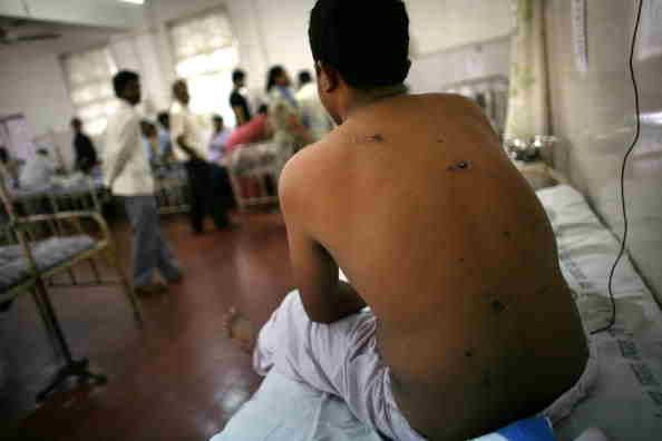 Porcine épidémie de grippe: le virus tue 75 en Inde