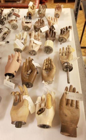 Trois hommes autrichiens se reconstruit mains bioniques
