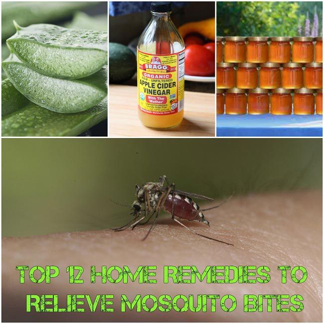 Top 12 remèdes maison pour soulager les piqûres de moustiques