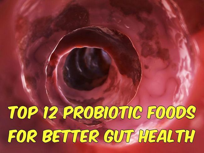 Top 12 probiotiques Foods pour une meilleure santé Gut