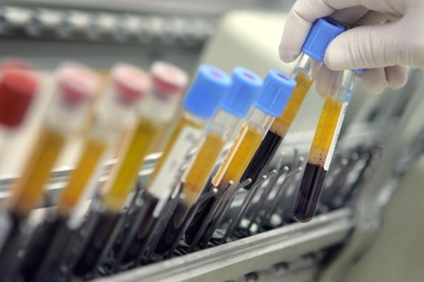 Laboratoire israélienne mène monde occidental dans les tests de sang