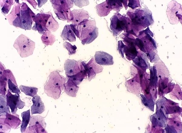 Une vue microscopique des cellules cervicales normales, prise avec un test de Pap.