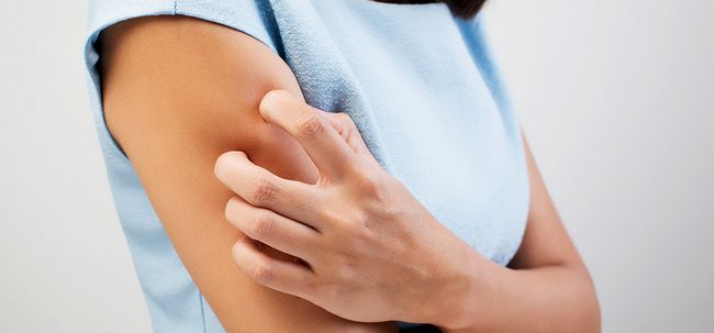 10 Symptômes et traitements pour les allergies de la peau sèche