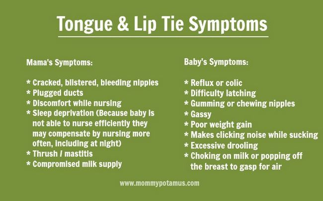 tongue-tie-symptômes-5