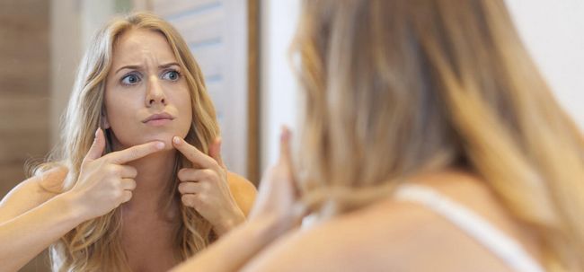 5 façons simples pour se débarrasser de l'acné menton