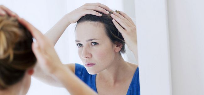 7 moyens efficaces pour traiter la perte de cheveux due à un déséquilibre hormonal