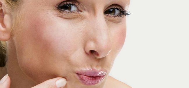9 façons de prendre soin de boutons sur bouche et des lèvres