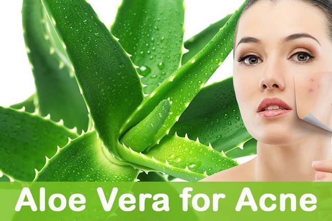 Aloe Vera pour l'acné
