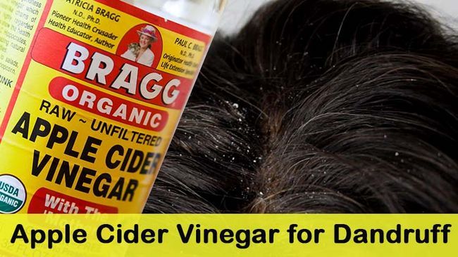 Apple Cider Vinegar pour les pellicules