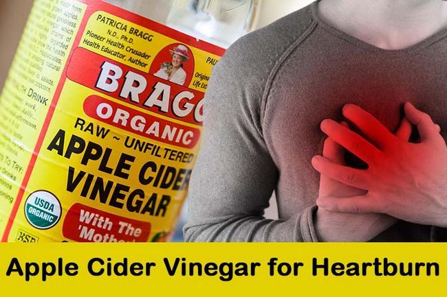 Apple Cider Vinegar pour les brûlures d'estomac