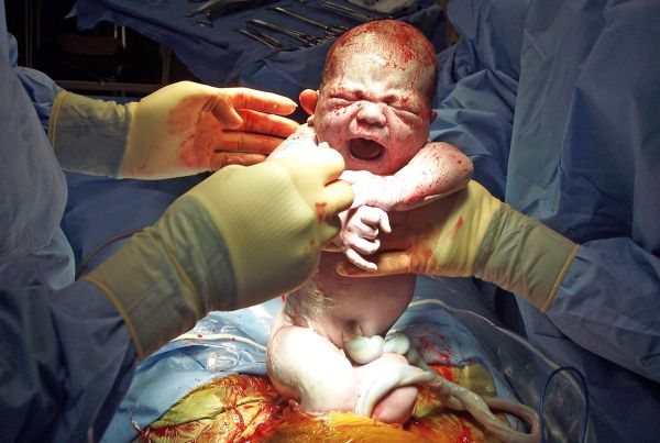 Procédures de la naissance de l'hôpital sont-ils dangereux?
