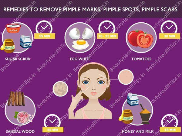 Meilleurs remèdes maison pour enlever les marques de Pimple, les cicatrices et les taches de Pimple