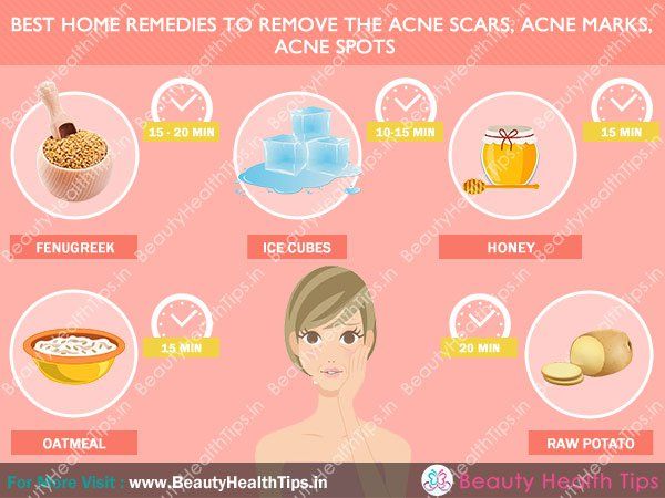 Meilleurs remèdes maison pour éliminer les cicatrices d'acné, l'acné, les marques taches d'acné