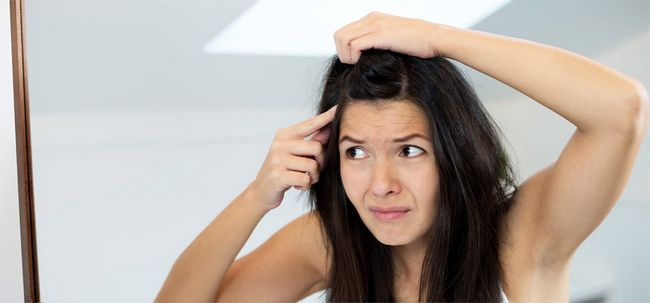 Les pellicules peuvent causer la perte des cheveux?