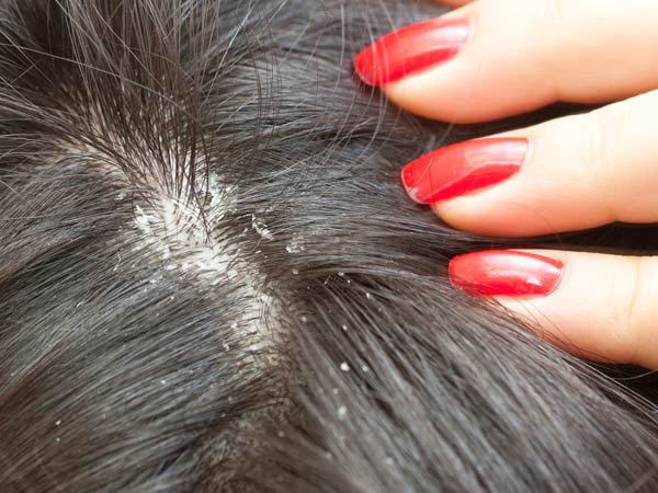 conseils de la croissance des cheveux de l'homéopathie