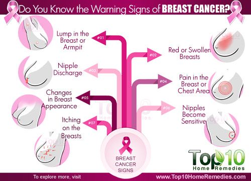 signes avant-coureurs du cancer du sein