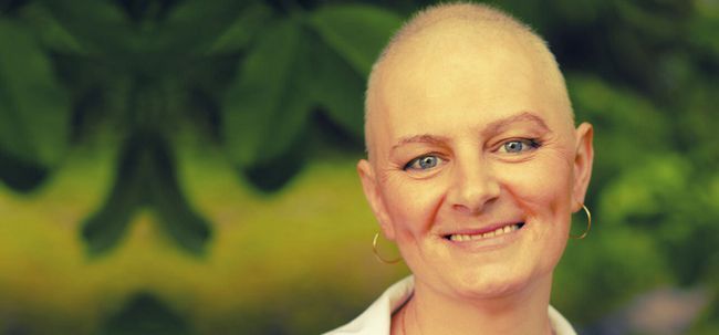 Est-ce que la chimiothérapie conduire à la perte de cheveux?