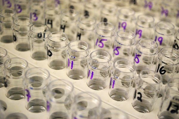 Faits fascinants sur la recherche sur les cellules souches