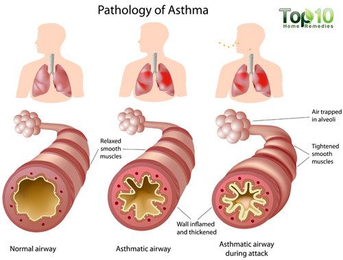 l'asthme anatomie