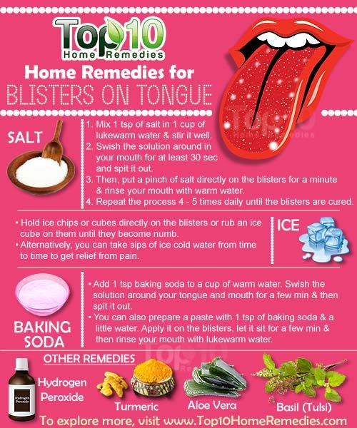 remèdes maison pour des cloques sur la langue