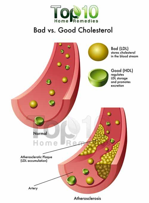Remèdes à la maison pour le cholestérol élevé