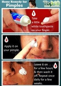 remède à la maison Pimple