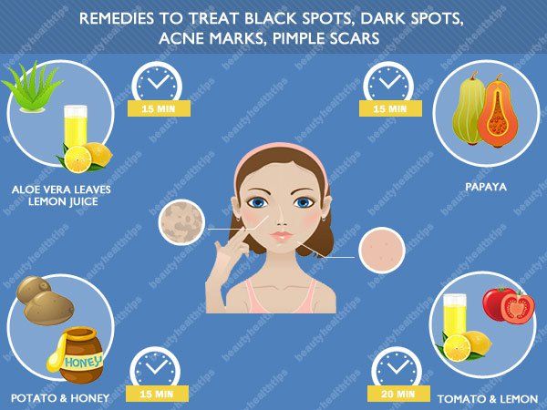 Accueil remèdes pour traiter les taches noires, des taches sombres, les marques d'acné, les cicatrices Pimple sur le visage