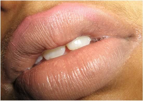 comment appliquer le rouge à lèvres sur les lèvres minces 2