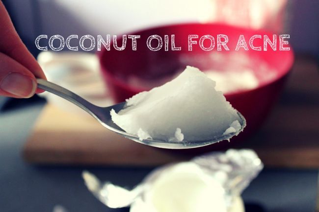 l'huile de coco pour l'acné