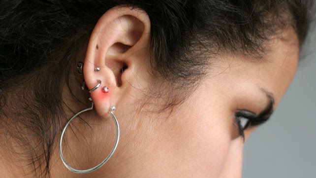 Comment guérir l'infection de perçage des oreilles
