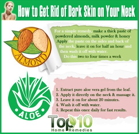 Comment se débarrasser de la peau foncé sur votre cou