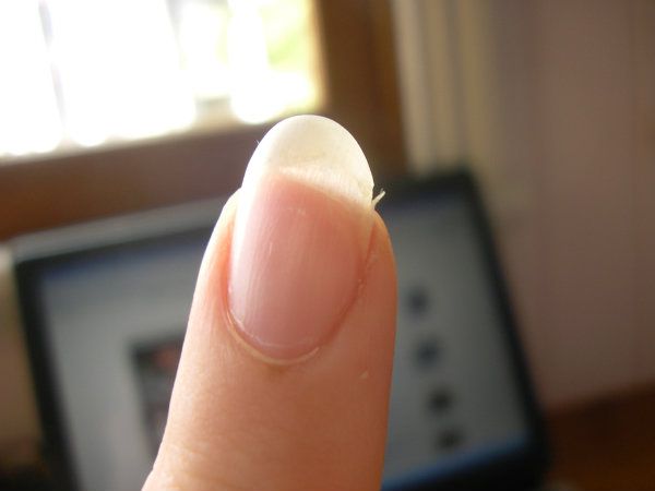 Comment se débarrasser de hangnails?