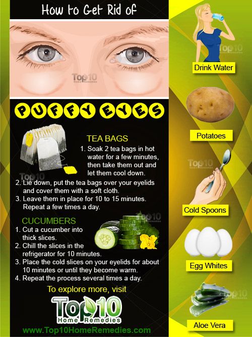 how-to-get-débarrasser des yeux gonflés