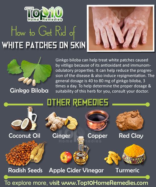 comment se débarrasser de blanc-patches vitiligo
